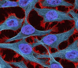 Henrietta Lacks’ Estate Settles with Novartis over HeLa Cells