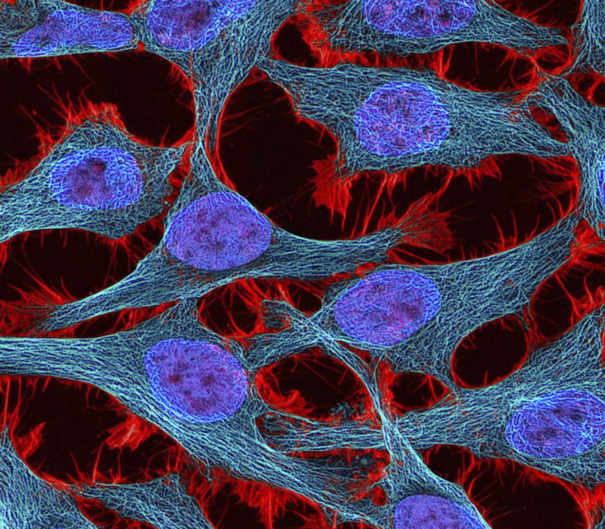 Henrietta Lacks’ Estate Settles with Novartis over HeLa Cells