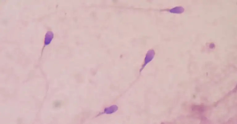 Air Pollution Destroys Sperm, Harms Babies for Life