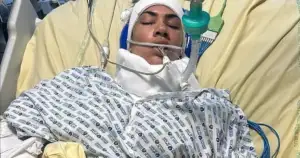 Sleepwalking Mom fell off Tenerife Balcony- Now Severe Brain Injury!