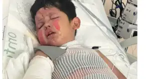 7-Year-Old Boy Burned in House Fire After DIY Chemistry Gone Wrong