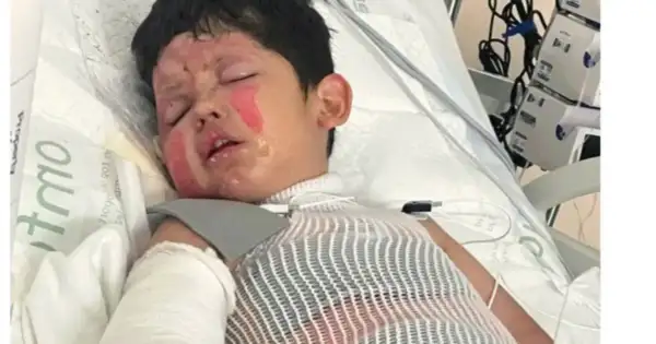 7-Year-Old Boy Burned in House Fire After DIY Chemistry Gone Wrong